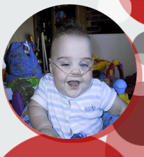 oxygen dependent child with canula